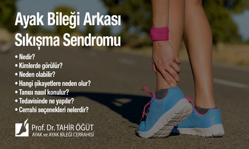 Ayak Bileği Sıkışma (impingement) Hastalığı